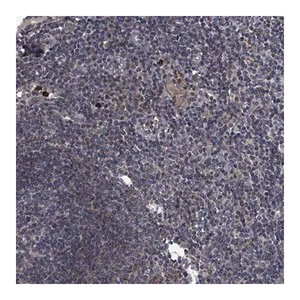 Merck Anti-KBTBD8 antibody produced in rabbit