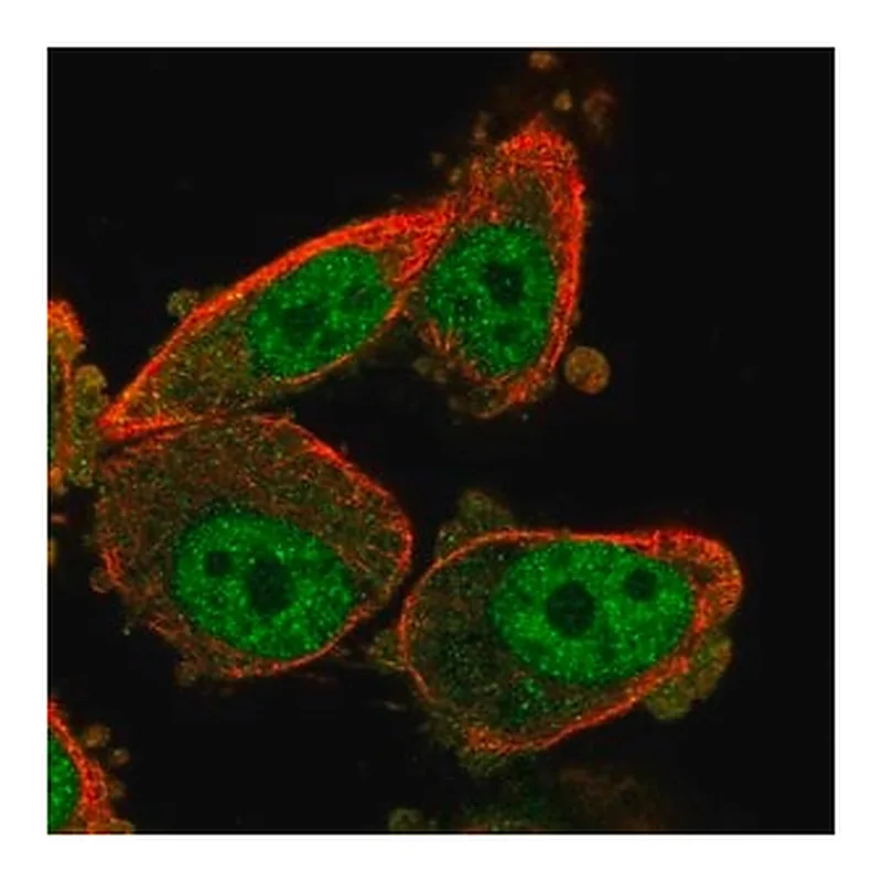 Merck Anti-WT1 antibody produced in rabbit