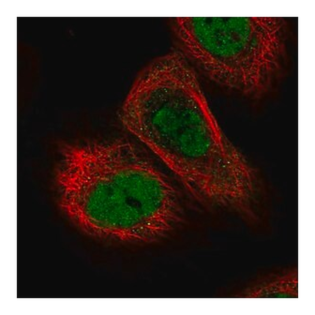 Merck Anti-TICRR antibody produced in rabbit
