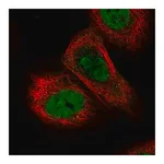 Merck Anti-TICRR antibody produced in rabbit