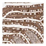 Merck Anti-SLC29A1 antibody produced in rabbit