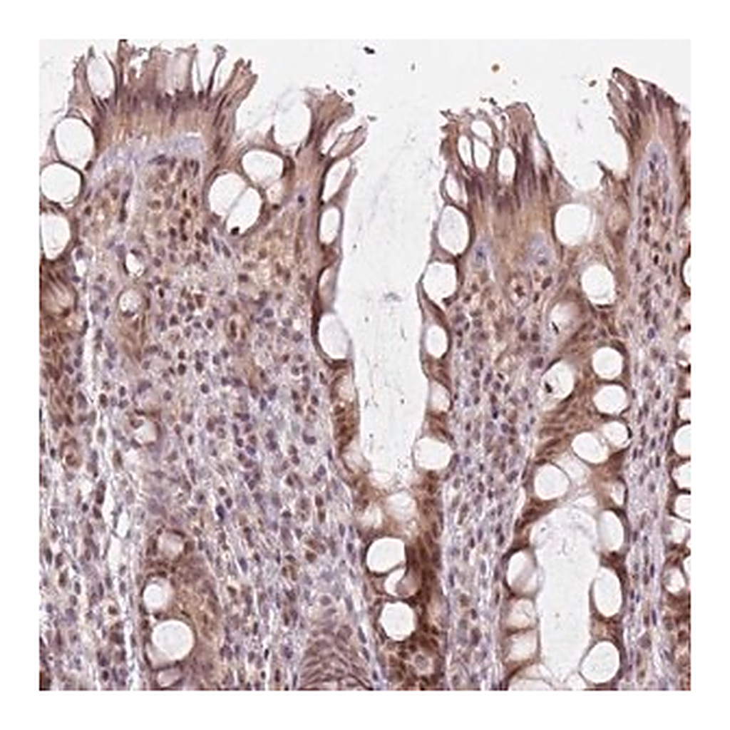 Merck Anti-KAT6A antibody produced in rabbit