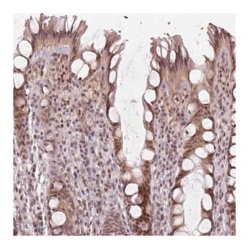 Merck Anti-KAT6A antibody produced in rabbit
