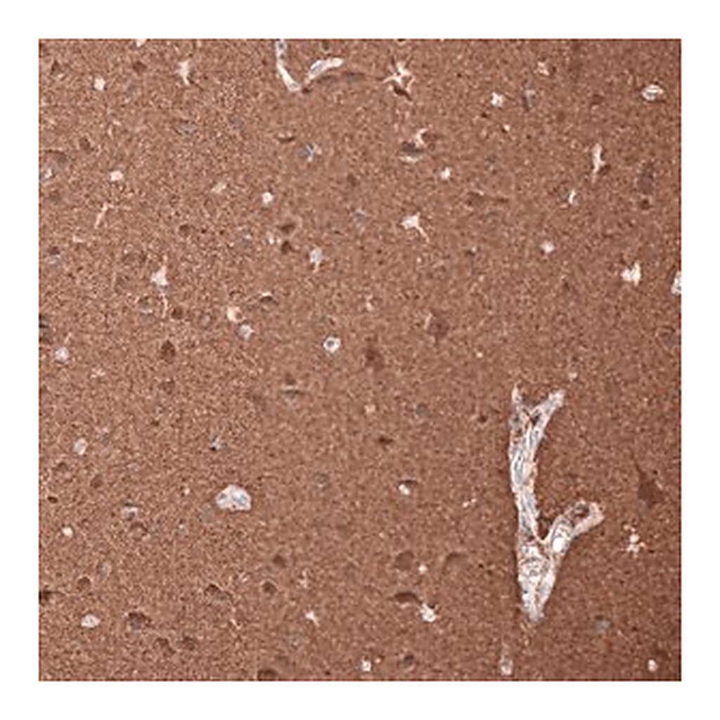 Merck Monoclonal Anti-TUBB3 antibody produced in mouse