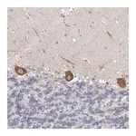 Merck Anti-OTUD3 antibody produced in rabbit