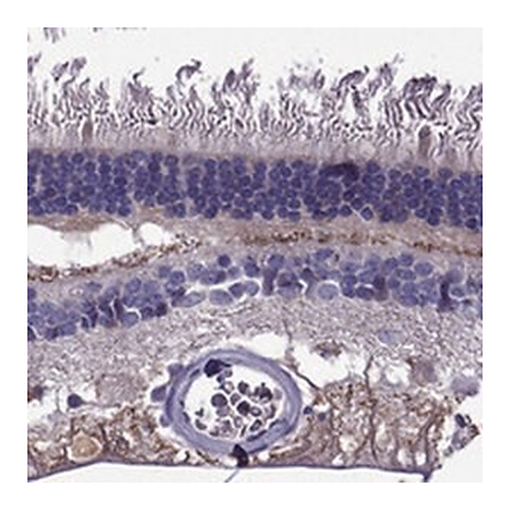 Merck Anti-PI16 antibody produced in rabbit