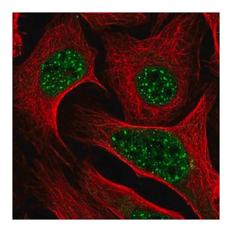 Merck Anti-DLX2 antibody produced in rabbit