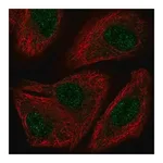 Merck Anti-TOX2 antibody produced in rabbit