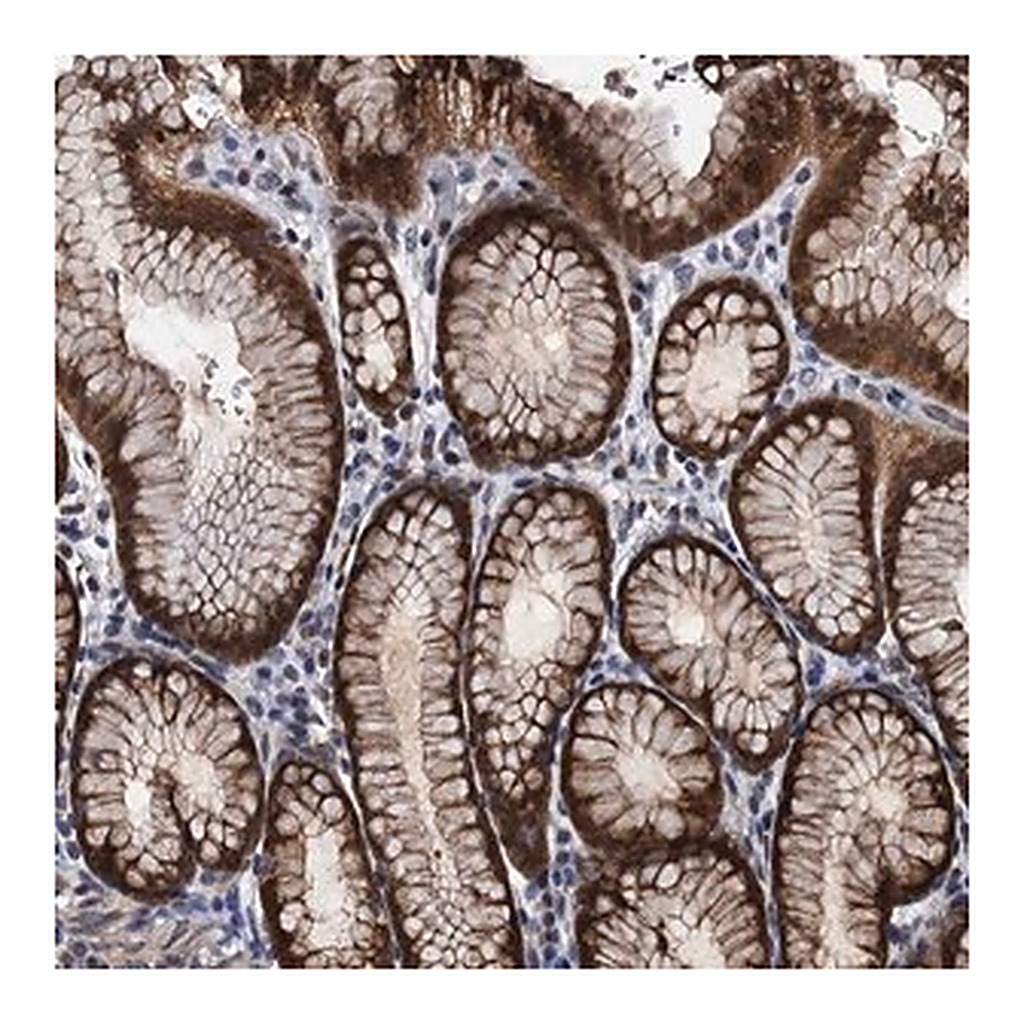 Merck Anti-FAM222A antibody produced in rabbit
