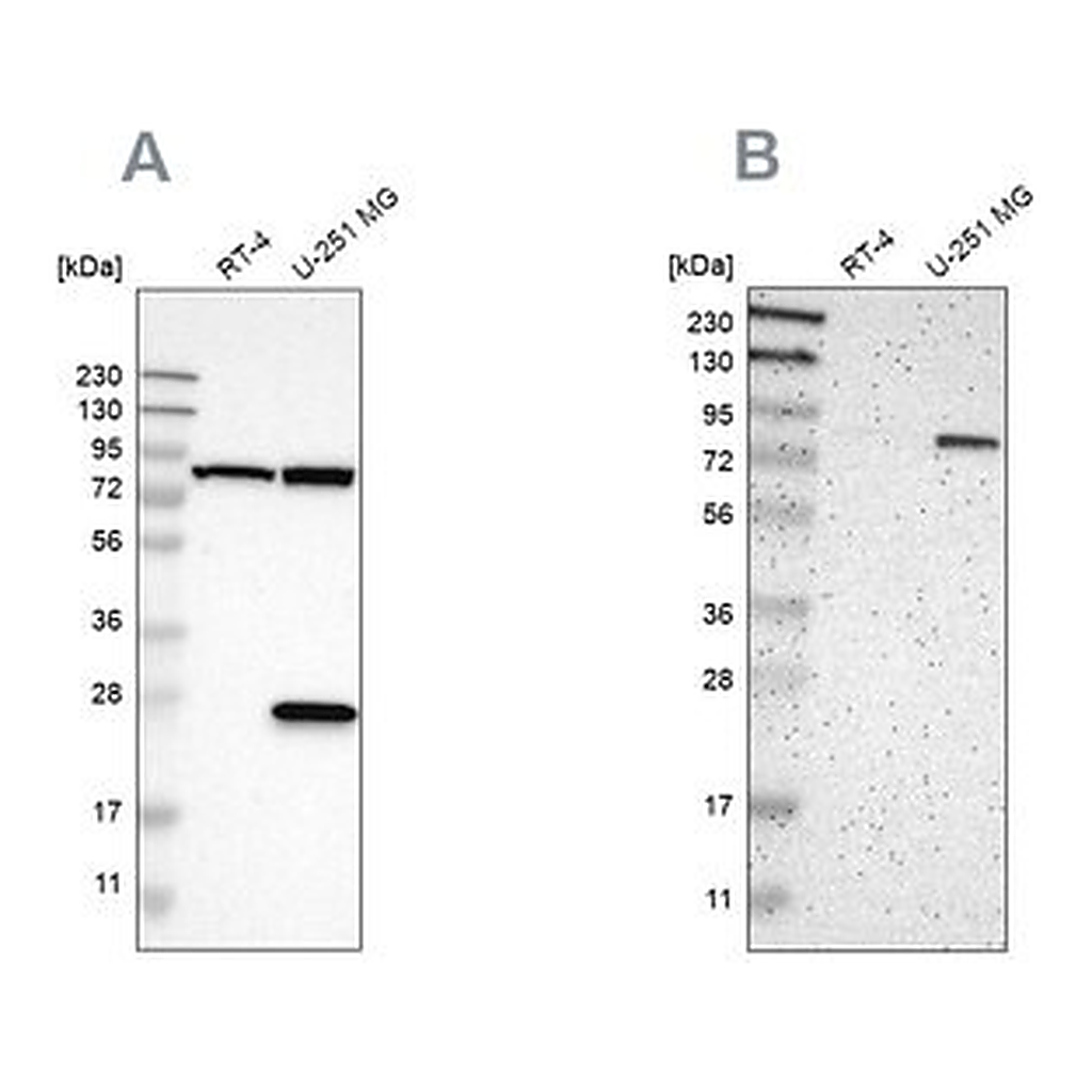 Merck Anti-ALDH18A1 antibody produced in rabbit