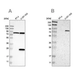 Merck Anti-ALDH18A1 antibody produced in rabbit