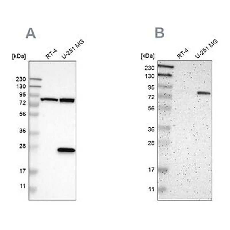 Merck Anti-ALDH18A1 antibody produced in rabbit