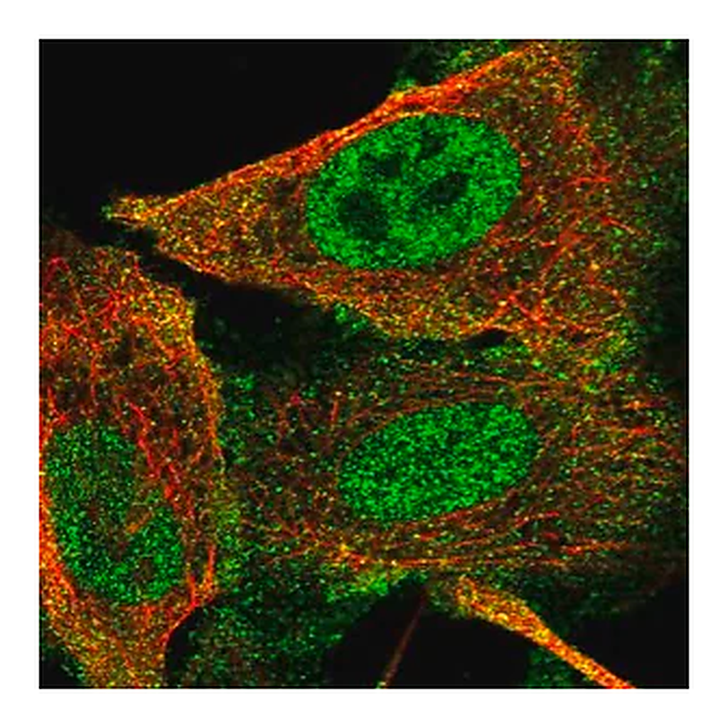 Merck Anti-GLI1 antibody produced in rabbit