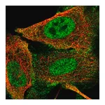 Merck Anti-GLI1 antibody produced in rabbit