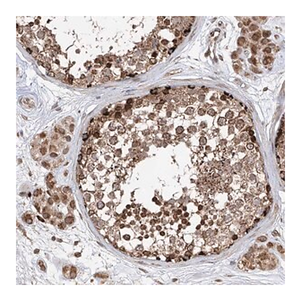 Merck Anti-AHCTF1 antibody produced in rabbit