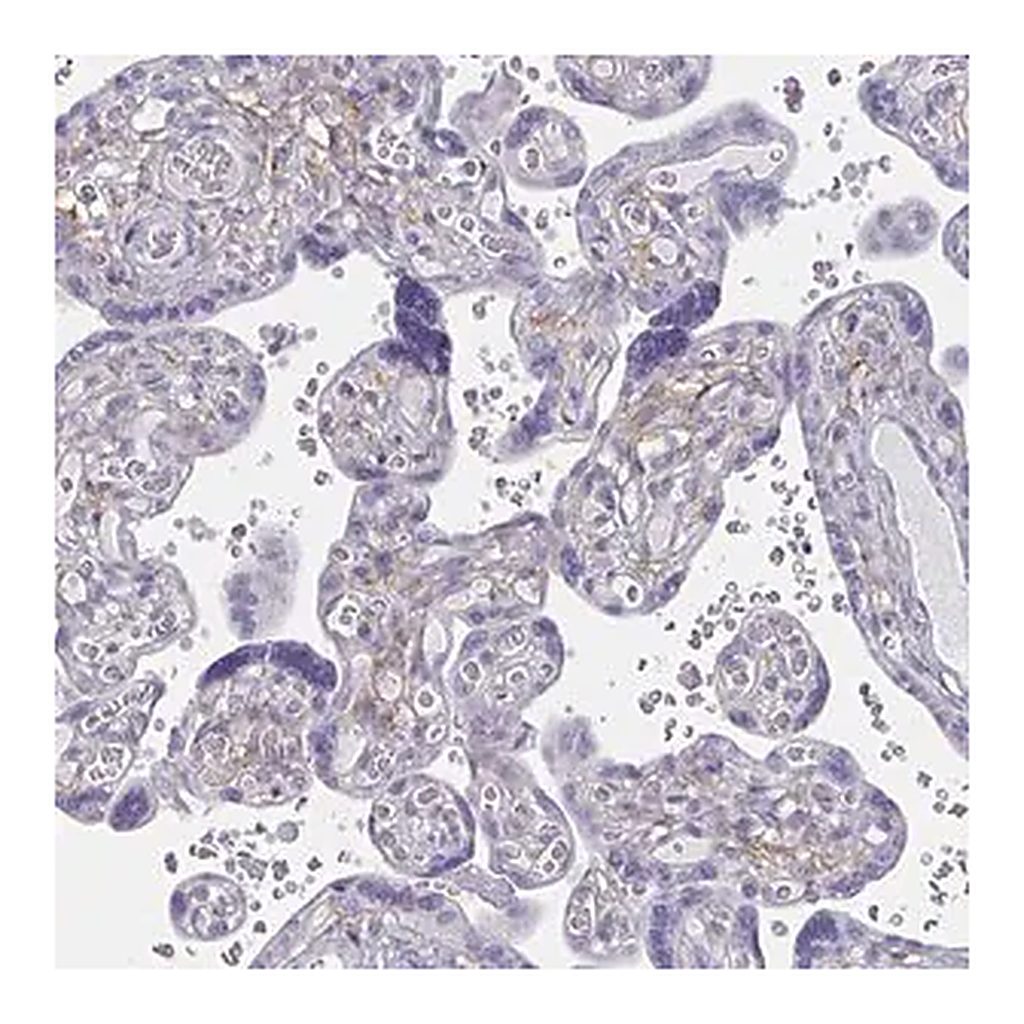 Merck Anti-ENPP1 antibody produced in rabbit