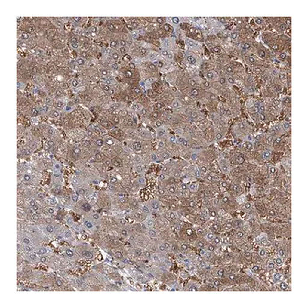 Merck Anti-PFKL antibody produced in rabbit