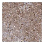 Merck Anti-PFKL antibody produced in rabbit