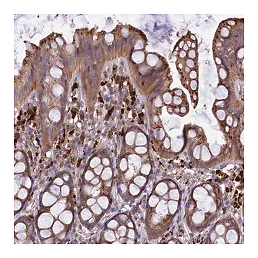 Merck Anti-CARMIL2 antibody produced in rabbit