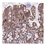 Merck Anti-CARMIL2 antibody produced in rabbit