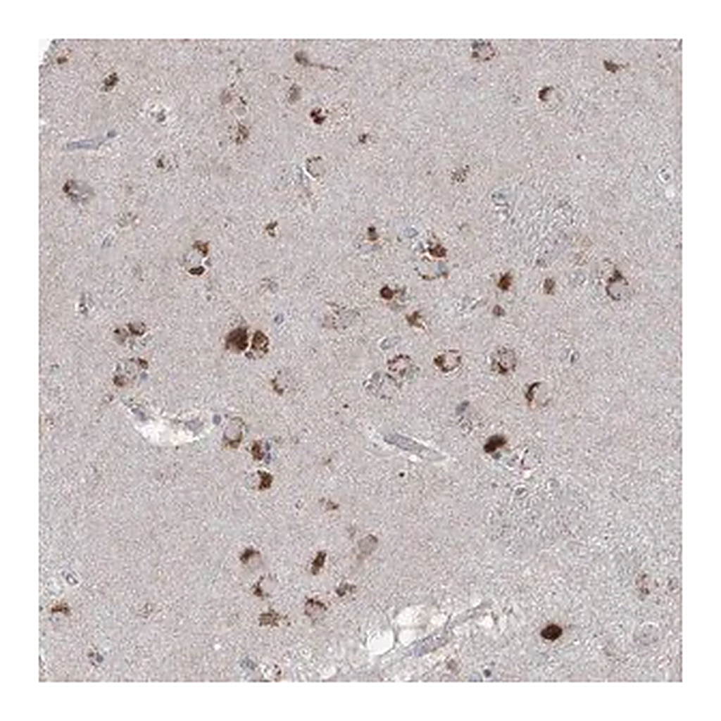 Merck Anti-AGPS antibody produced in rabbit