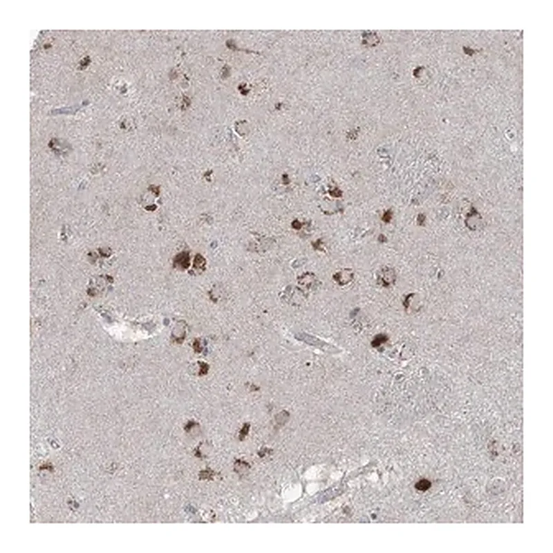 Merck Anti-AGPS antibody produced in rabbit
