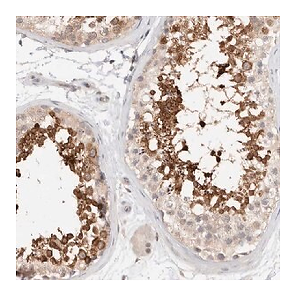 Merck Anti-C17orf97 antibody produced in rabbit