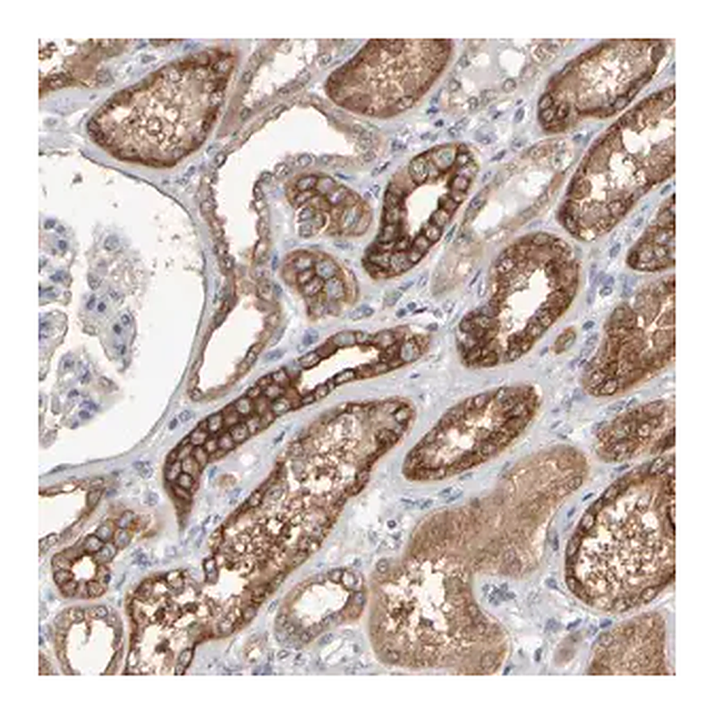 Merck Anti-EPHX2 antibody produced in rabbit