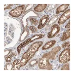 Merck Anti-EPHX2 antibody produced in rabbit