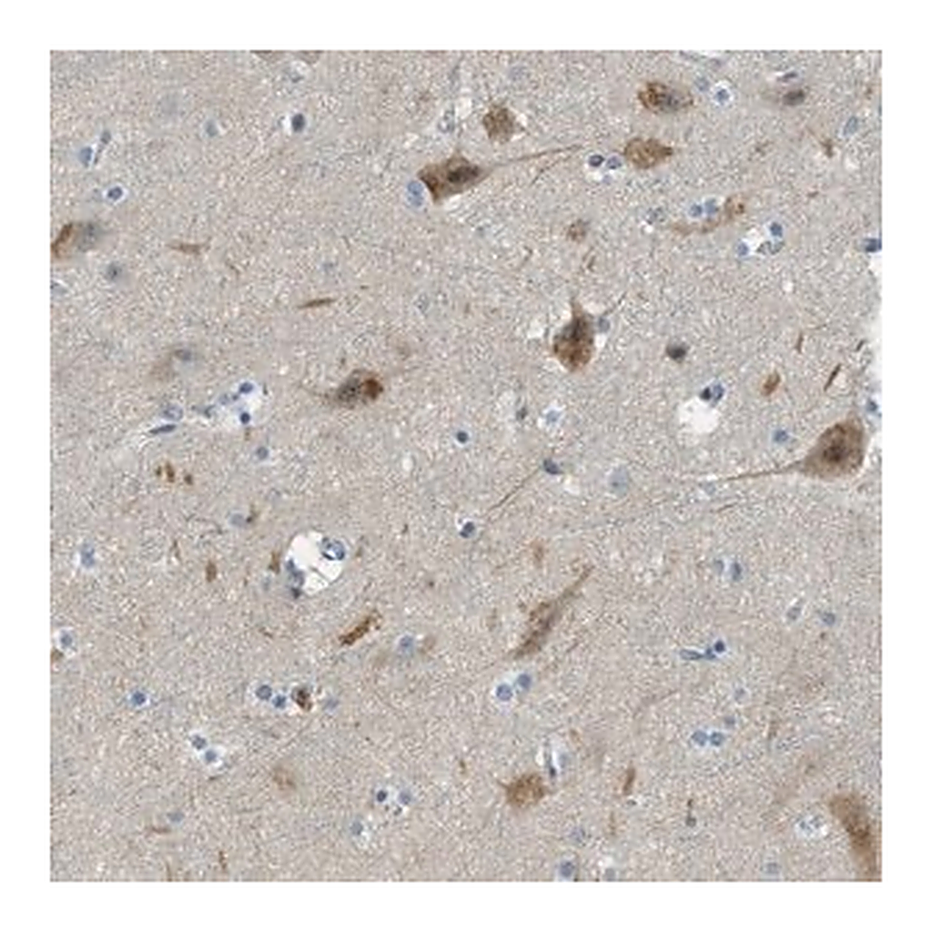 Merck Anti-SNX14 antibody produced in rabbit