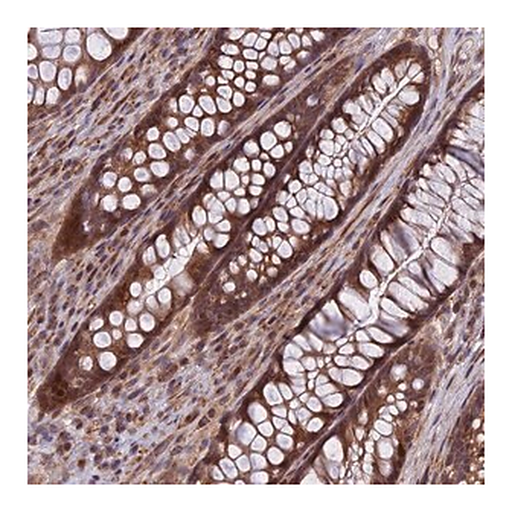 Merck Anti-COMMD2 antibody produced in rabbit