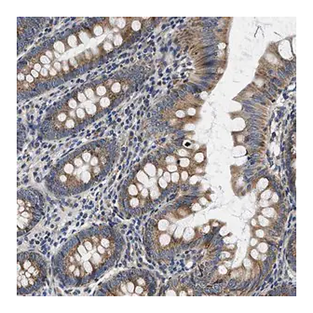 Merck Anti-SAMD4B antibody produced in rabbit