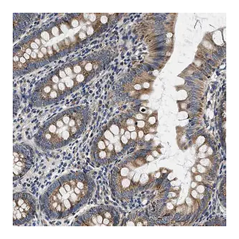 Merck Anti-SAMD4B antibody produced in rabbit