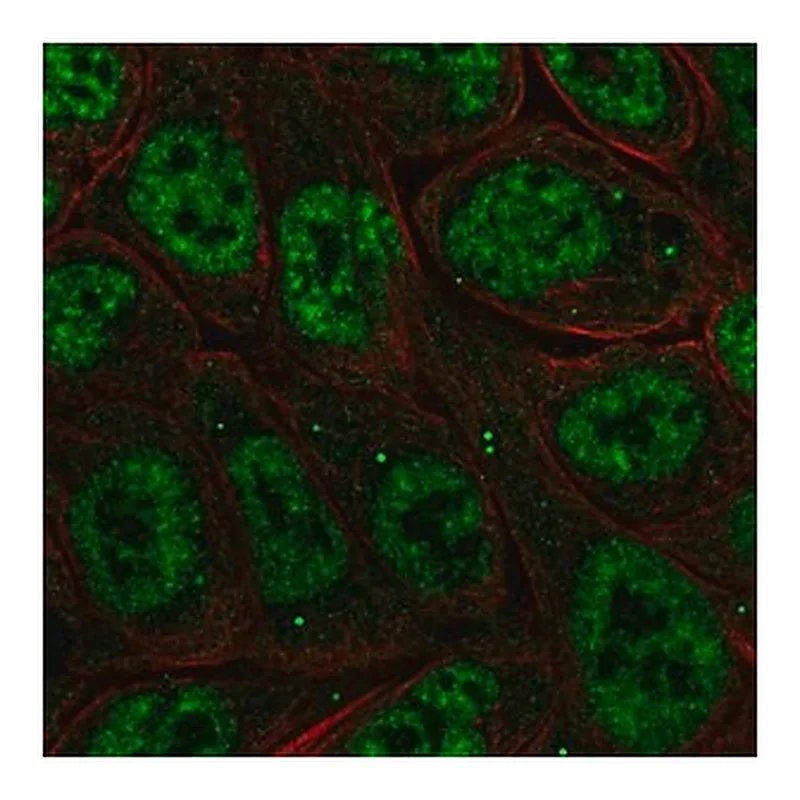 Merck Anti-NFKBIZ antibody produced in rabbit