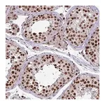Merck Anti-TTF1 antibody produced in rabbit