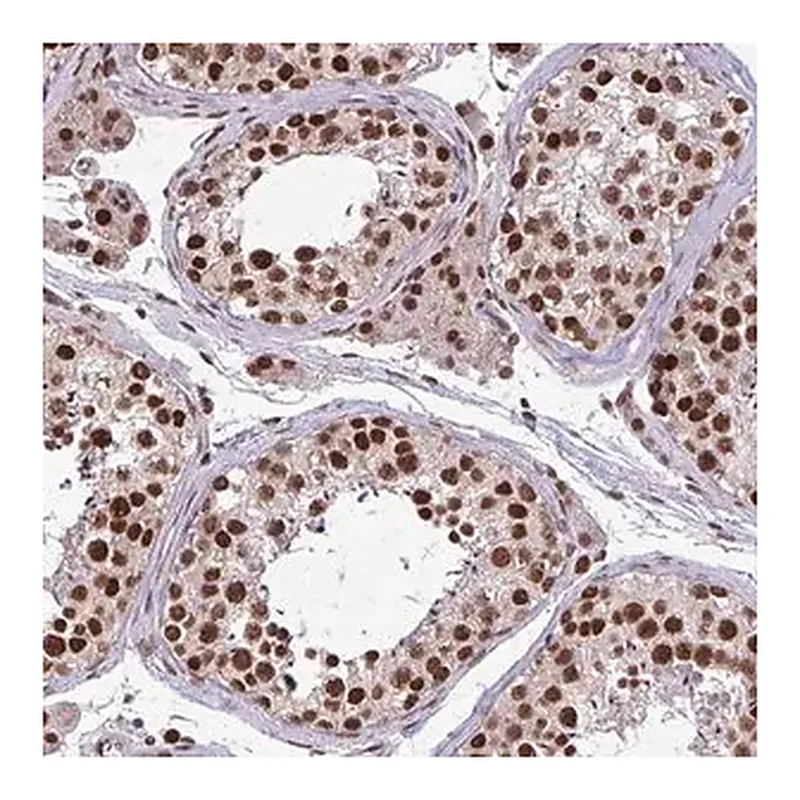 Merck Anti-TTF1 antibody produced in rabbit