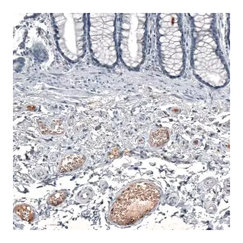 Merck Anti-CXCL8 antibody produced in rabbit
