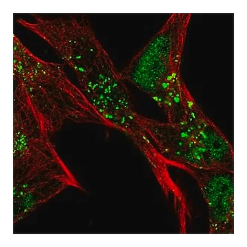 Merck Anti-SLC16A6 antibody produced in rabbit