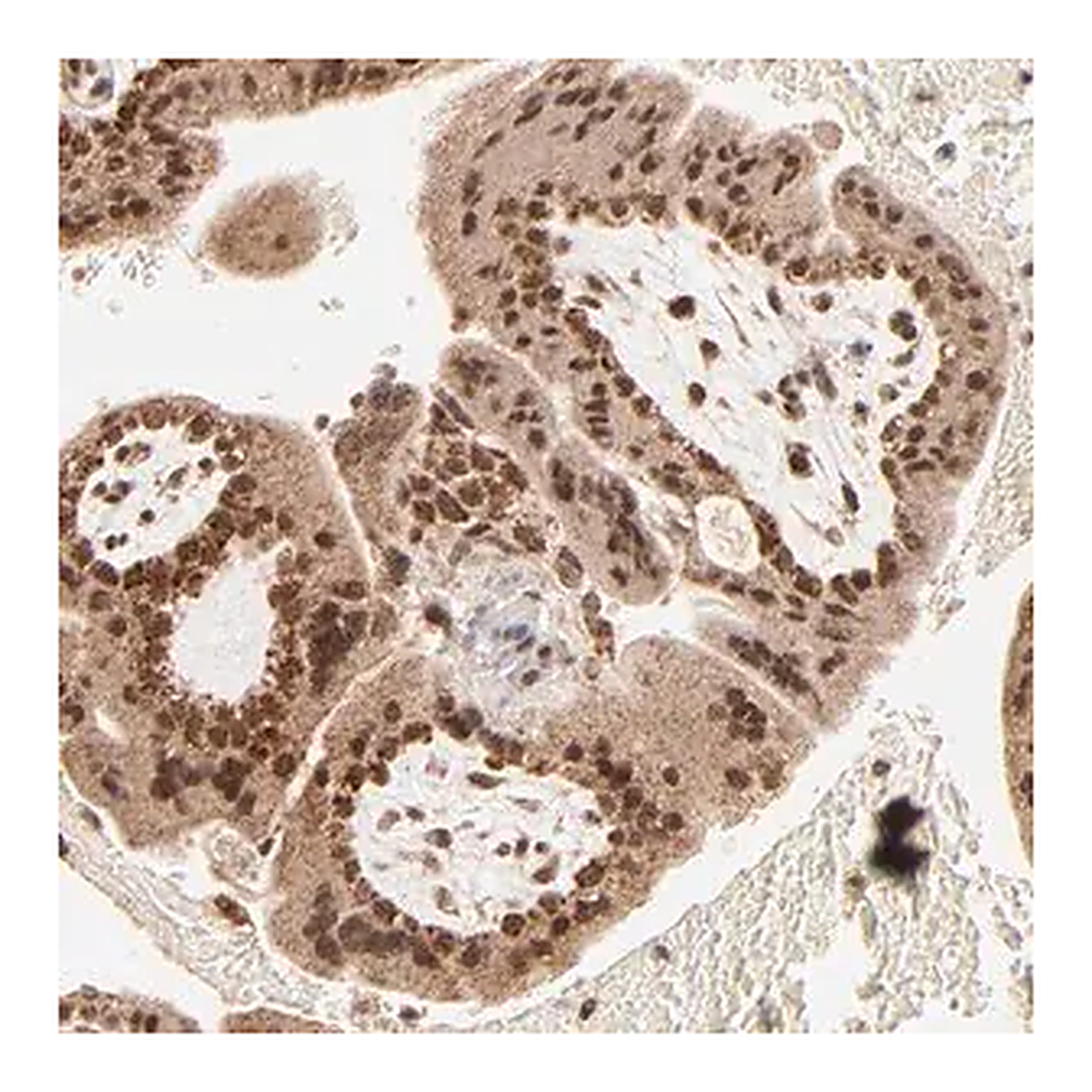Merck Anti-MED15 antibody produced in rabbit