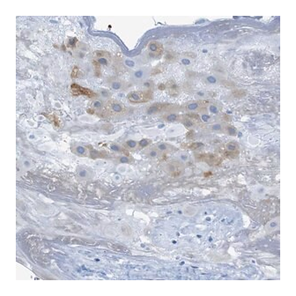 Merck Anti-ERVMER34-1 antibody produced in rabbit