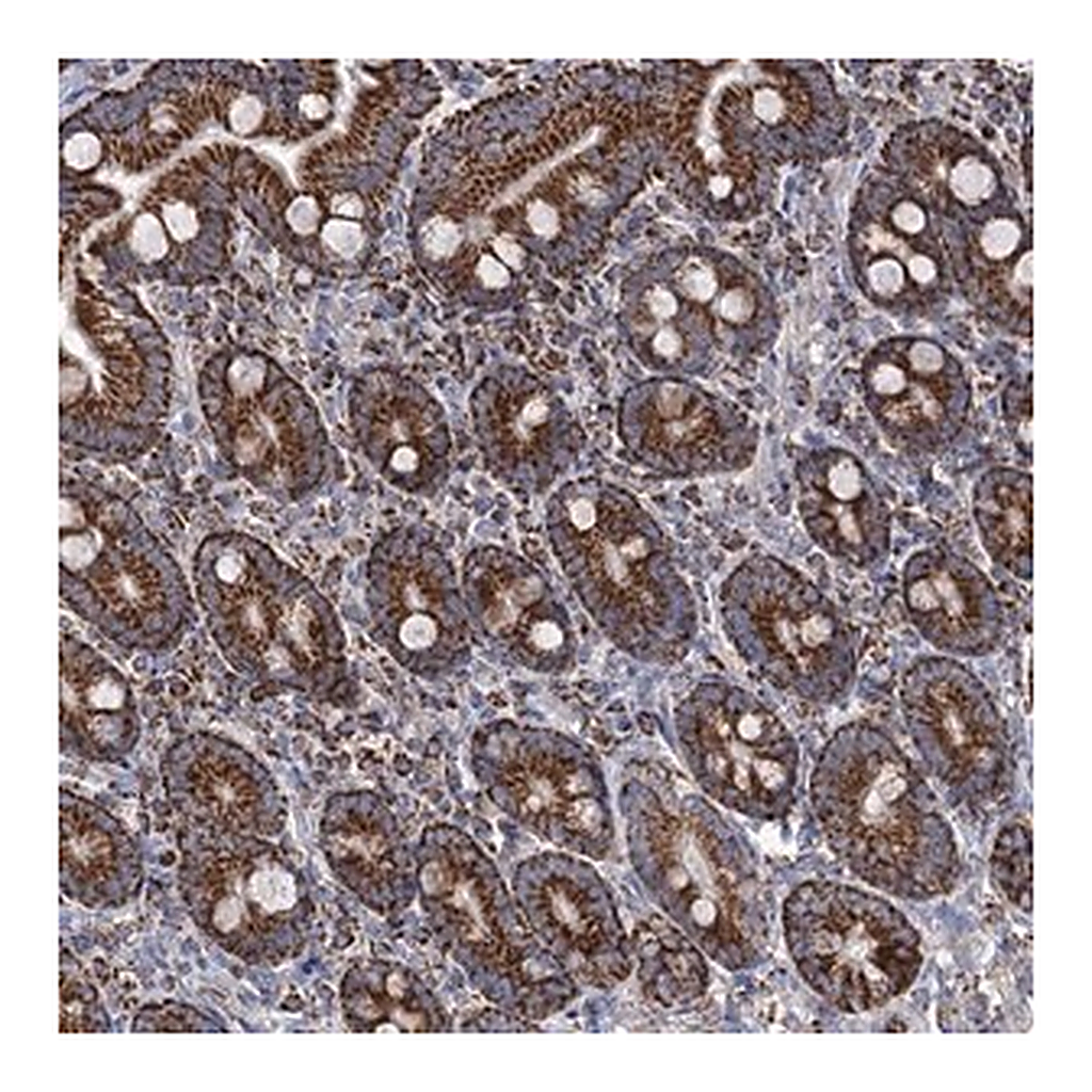 Merck Anti-ABHD10 antibody produced in rabbit