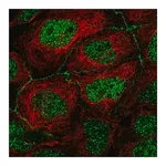 Merck Anti-APOC3 antibody produced in rabbit