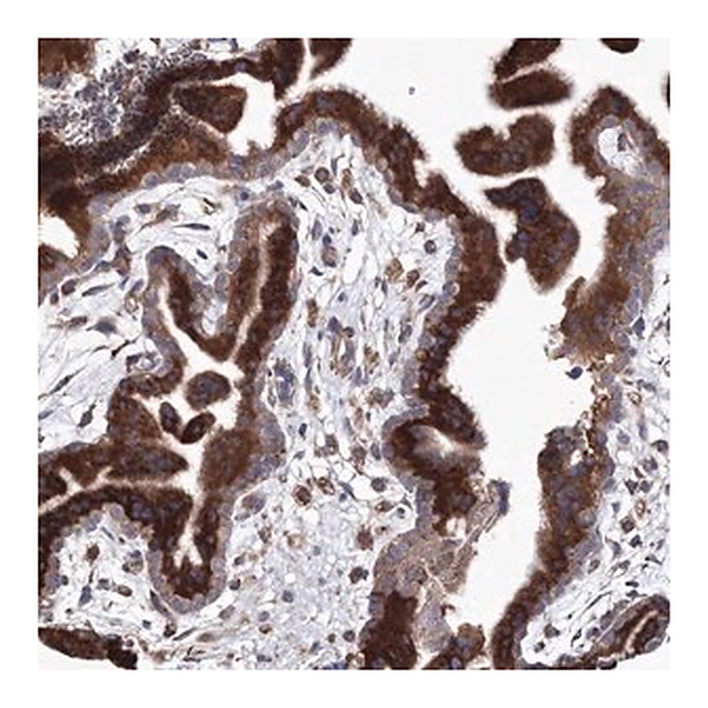 Merck Anti-VPS8 antibody produced in rabbit