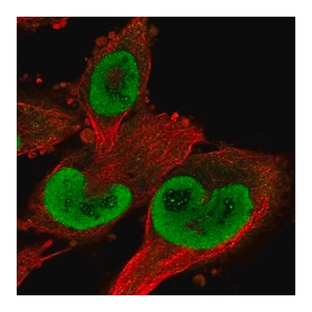 Merck Anti-TXNRD1 antibody produced in rabbit