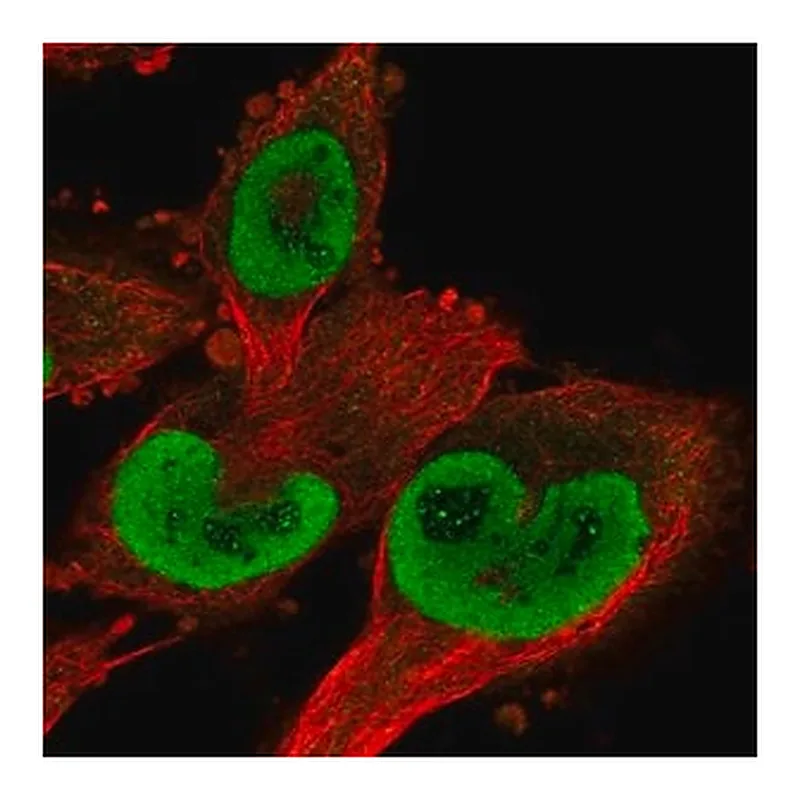 Merck Anti-TXNRD1 antibody produced in rabbit