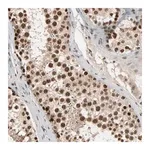 Merck Anti-SMARCD1 antibody produced in rabbit