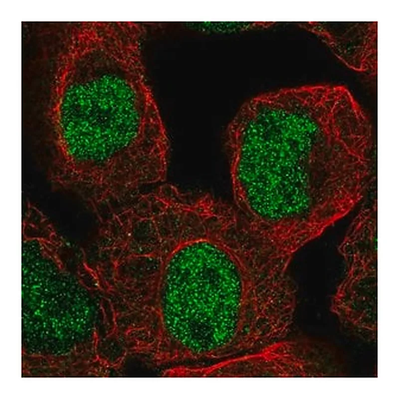 Merck Anti-KDM4C antibody produced in rabbit