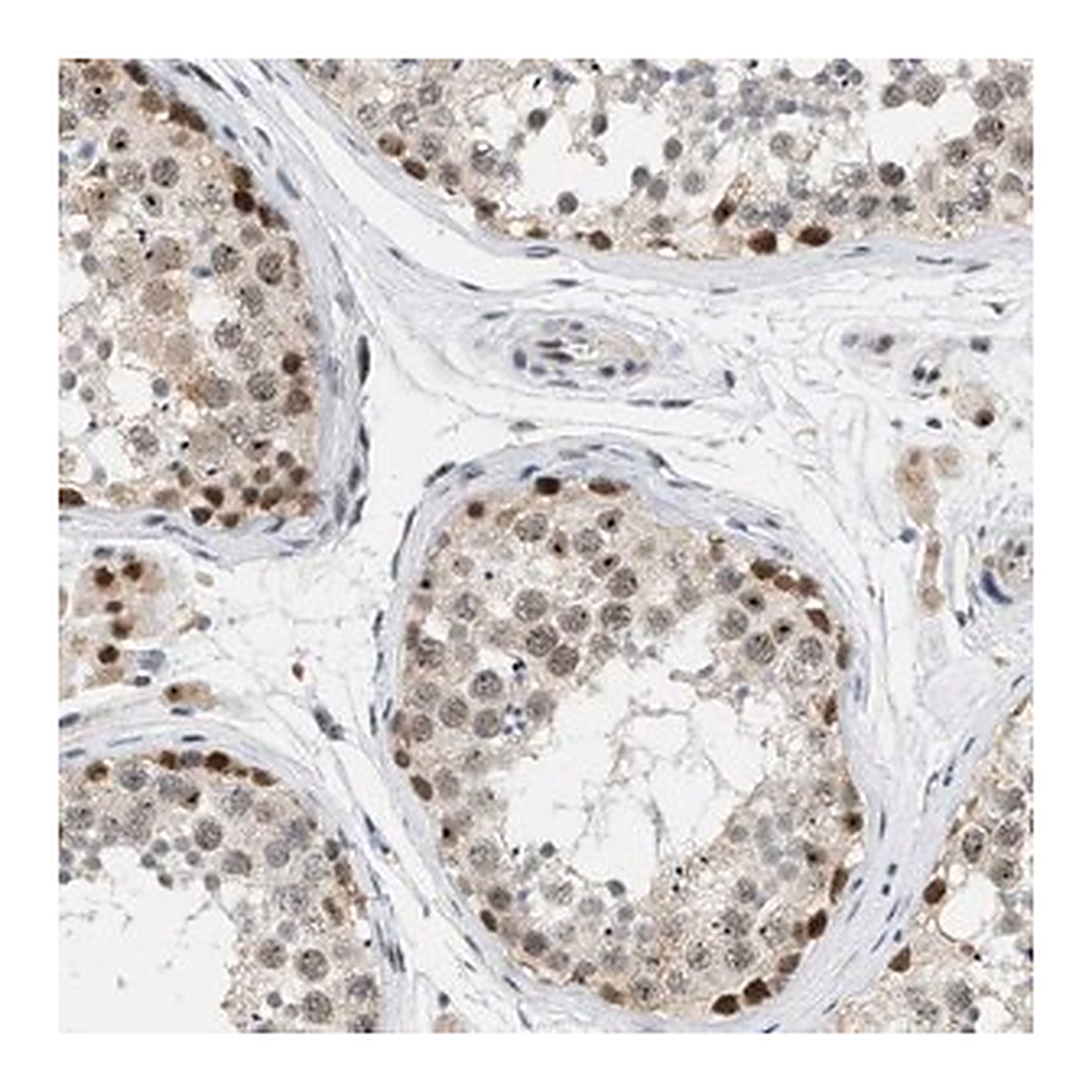 Merck Anti-ELAC2 antibody produced in rabbit
