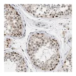 Merck Anti-ELAC2 antibody produced in rabbit