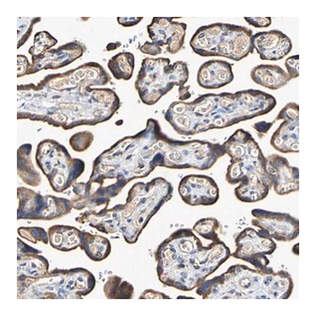 Merck Anti-IL18R1 antibody produced in rabbit
